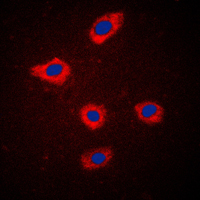 SCGB2A2 / Mammaglobin A Antibody - Immunofluorescent analysis of Mammaglobin A staining in MCF7 cells. Formalin-fixed cells were permeabilized with 0.1% Triton X-100 in TBS for 5-10 minutes and blocked with 3% BSA-PBS for 30 minutes at room temperature. Cells were probed with the primary antibody in 3% BSA-PBS and incubated overnight at 4 C in a humidified chamber. Cells were washed with PBST and incubated with a DyLight 594-conjugated secondary antibody (red) in PBS at room temperature in the dark. DAPI was used to stain the cell nuclei (blue).