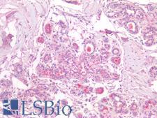 SCGB2A2 / Mammaglobin A Antibody - Human Breast: Formalin-Fixed, Paraffin-Embedded (FFPE)