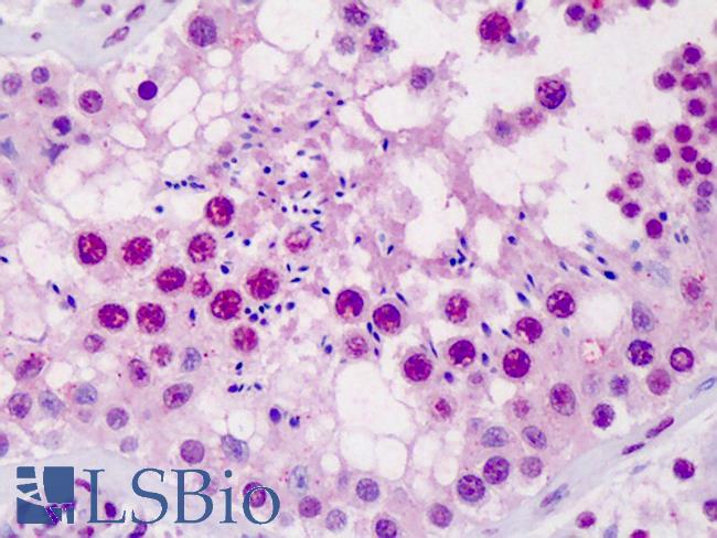 SCML1 Antibody - Anti-SCML1 antibody IHC of human testis. Immunohistochemistry of formalin-fixed, paraffin-embedded tissue after heat-induced antigen retrieval. Antibody concentration 5 ug/ml.