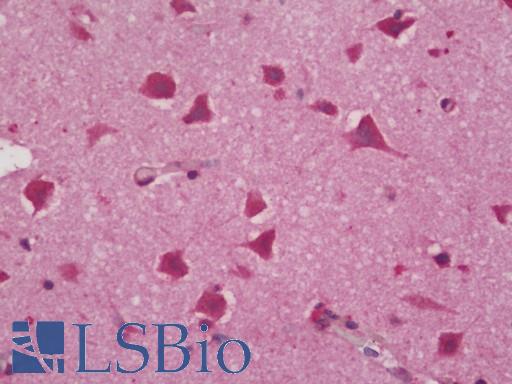 SCN1B Antibody - Human Brain, Cortex: Formalin-Fixed, Paraffin-Embedded (FFPE)