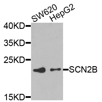 SCN2B Antibody - Western blot analysis of extracts of various cells.