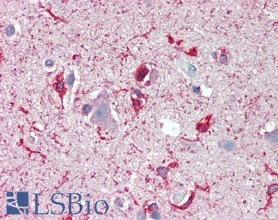 SCN2B Antibody - Human Brain, Cortex: Formalin-Fixed, Paraffin-Embedded (FFPE)