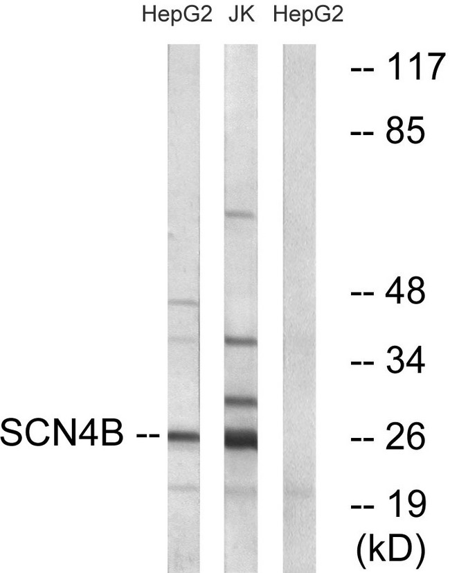 SCN4B Antibody - Western blot analysis of lysates from HepG2 and Jurkat cells, using SCN4B Antibody. The lane on the right is blocked with the synthesized peptide.