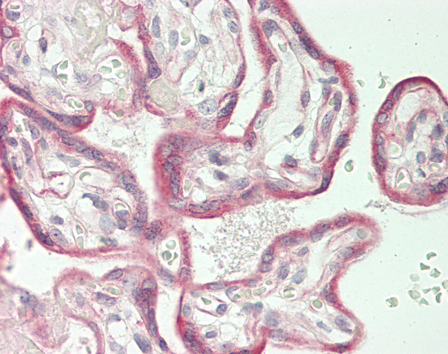 SCN9A / Nav1.7 Antibody - Human Placenta: Formalin-Fixed, Paraffin-Embedded (FFPE)