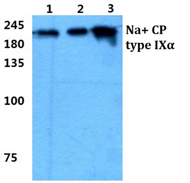 SCN9A / Nav1.7 Antibody - Western blot analysis of Anti-SCN9A Antibody at 1:500 dilution. Lane 1: MCF-7 cell lysate. Lane 2: NIH-3T3 cell lysate. Lane 3: H9C2 cell lysate.