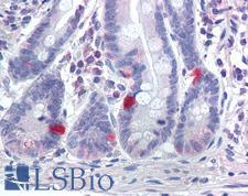 SCN9A / Nav1.7 Antibody - Anti-SCN9A / Nav1.7 antibody IHC of human small intestine, neuroendocrine cells. Immunohistochemistry of formalin-fixed, paraffin-embedded tissue after heat-induced antigen retrieval.