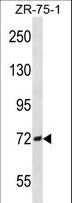 SCNN1B / ENaC Beta Antibody - SCNN1B Antibody western blot of ZR-75-1 cell line lysates (35 ug/lane). The SCNN1B antibody detected the SCNN1B protein (arrow).