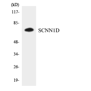 SCNN1D Antibody - Western blot analysis of the lysates from HT-29 cells using SCNN1D antibody.