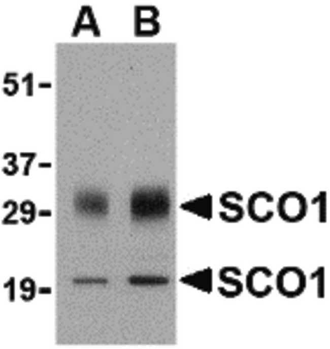 SCO1 Antibody - Western blot of SCO1 in human brain tissue lysate with SCO1 antibody at (A) 0.5 and (B) 1 ug/ml.