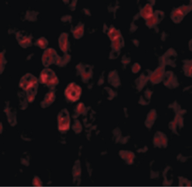 SCO2 Antibody - Immunofluorescence of SCO2 in Human Liver cells with SCO2 antibody at 20 ug/ml.