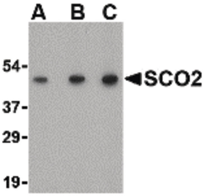 SCO2 Antibody - Western blot of SCO2 in human liver tissue lysate with SCO2 antibody at (A) 0.5, (B) 1 and (C) 2 ug/ml.
