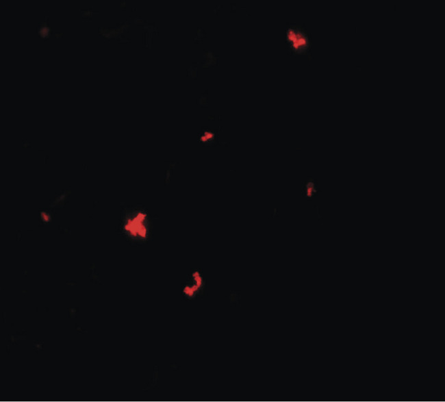 SCOP / PHLPP Antibody - Immunofluorescence of PHLPP1 in SW480 cells with PHLPP1 antibody at 5 ug/ml.