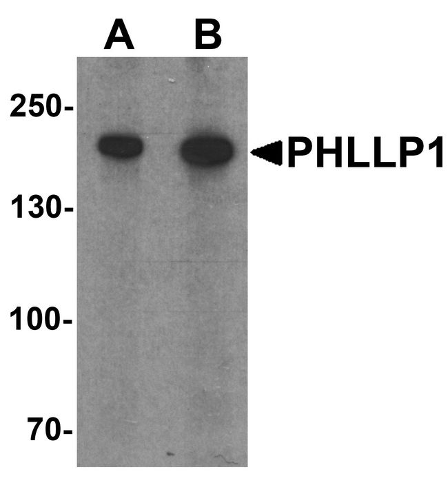 SCOP / PHLPP Antibody - Western blot analysis of PHLPP1 in SW480 cell lysate with PHLPP1 antibody at (A) 1 and (B) 2 ug/ml.