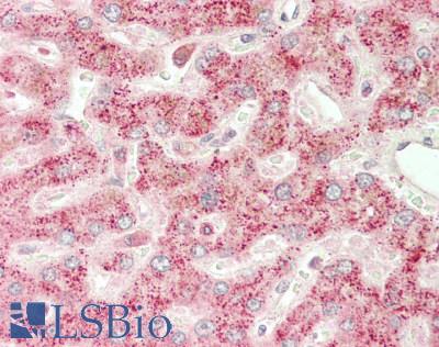 SCP2 / SCPX Antibody - Human Liver: Formalin-Fixed, Paraffin-Embedded (FFPE).  This image was taken for the unconjugated form of this product. Other forms have not been tested.