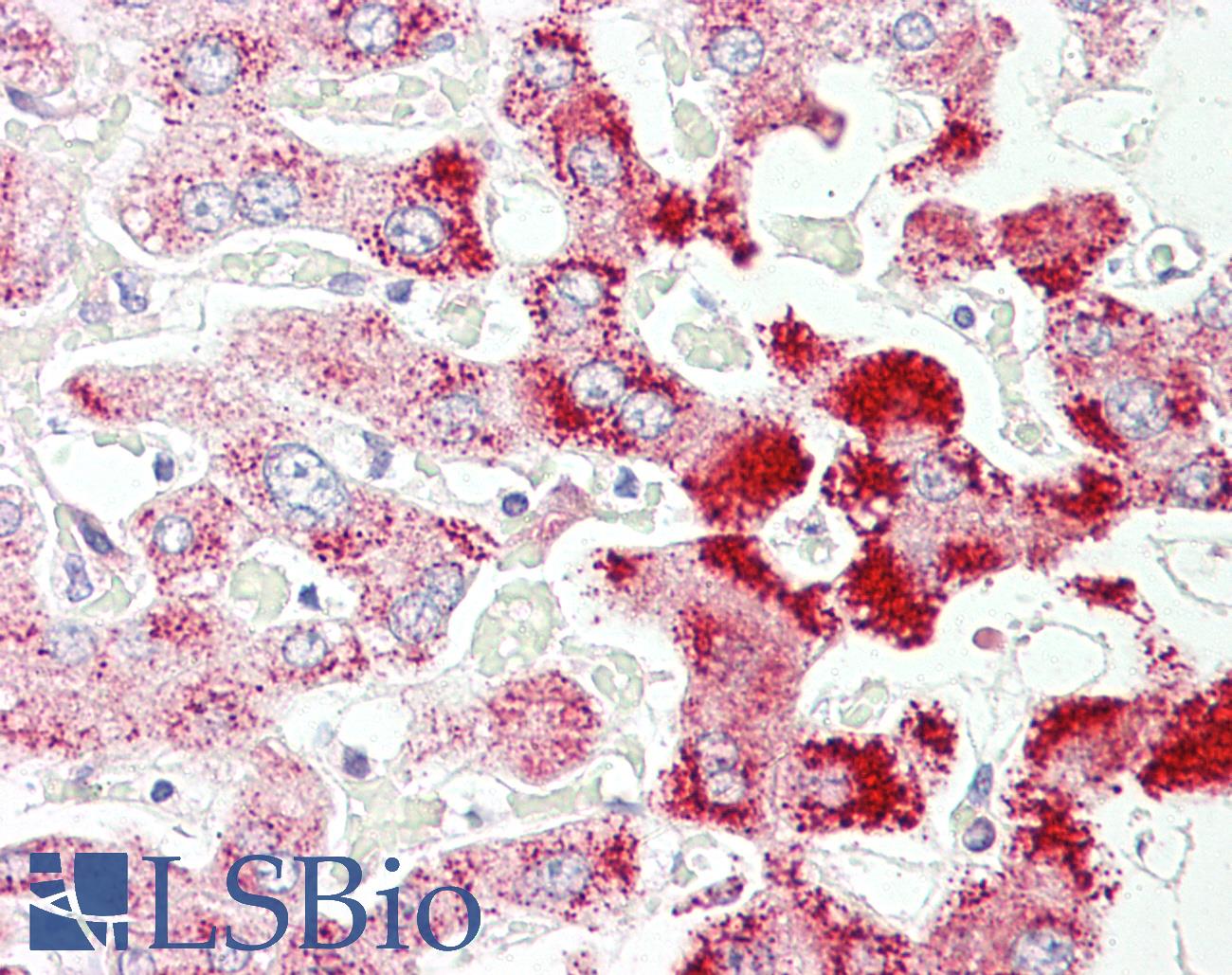 SCP2 / SCPX Antibody - Anti-SCP2 antibody IHC of human liver. Immunohistochemistry of formalin-fixed, paraffin-embedded tissue after heat-induced antigen retrieval. Antibody concentration 3.75 ug/ml.