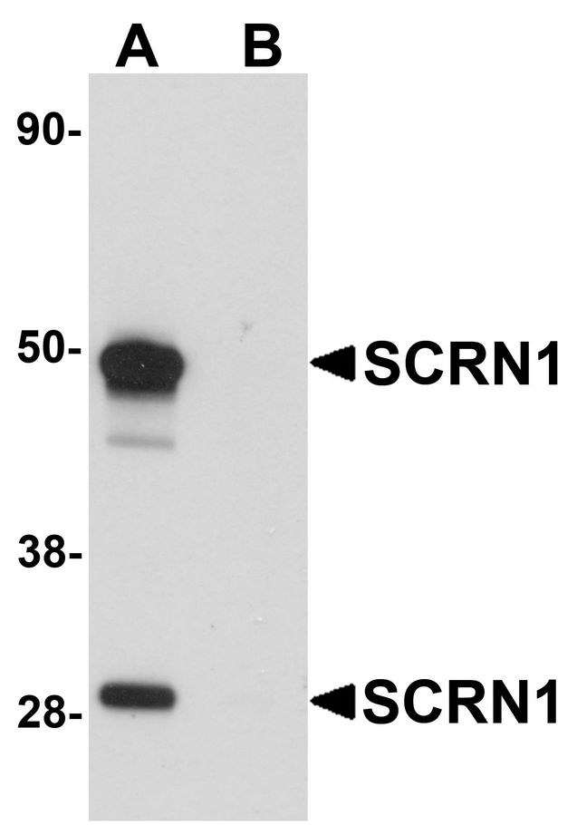 SCRN1 / Secernin 1 Antibody - Western blot analysis of SCRN1 in human kidney tissue lysate with SCRN1 antibody at 1 ug/ml in (A) the absence and (B) the presence of blocking peptide.
