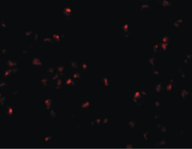 SCRN2 / Ses2 Antibody - Immunofluorescence of SCRN2 in 293 cells with SCRN2 antibody at 20 ug/ml.