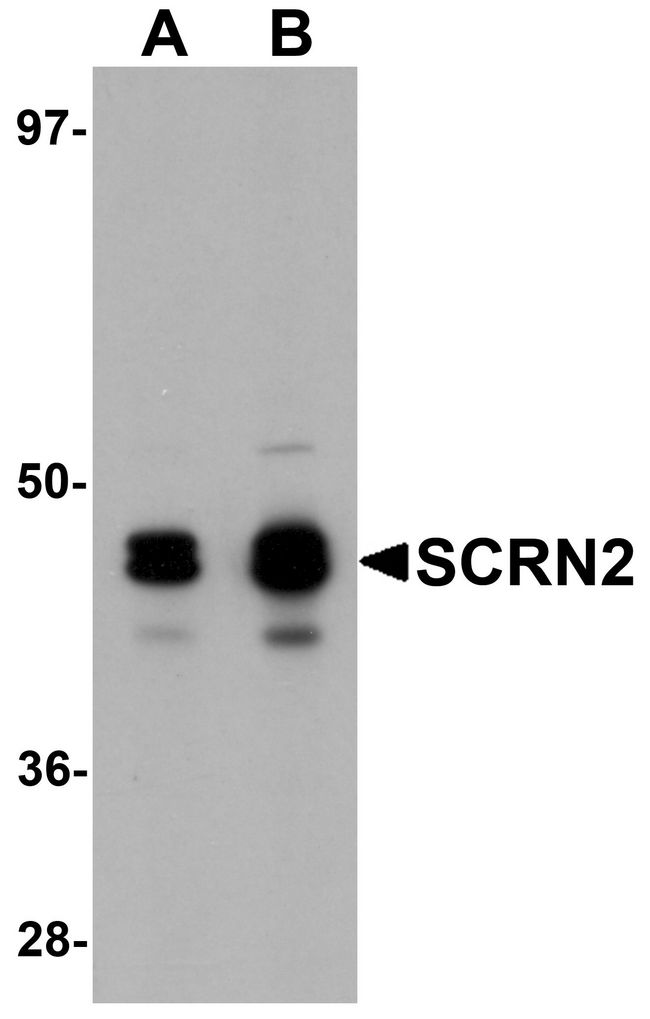 SCRN2 / Ses2 Antibody - Western blot analysis of SCRN2 in 293 cell tissue lysate with SCRN2 antibody at (A) 0.5 and (B) 1 ug/ml.