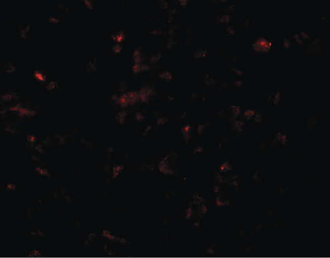 SCRN3 Antibody - Immunofluorescence of SCRN3 in 293 cells with SCRN3 antibody at 20 ug/ml.