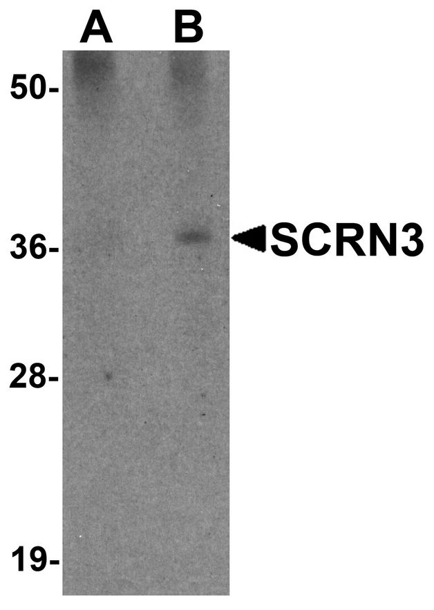 SCRN3 Antibody - Western blot analysis of SCRN3 in 293 cell tissue lysate with SCRN3 antibody at (A) 1 and (B) 2 ug/ml.