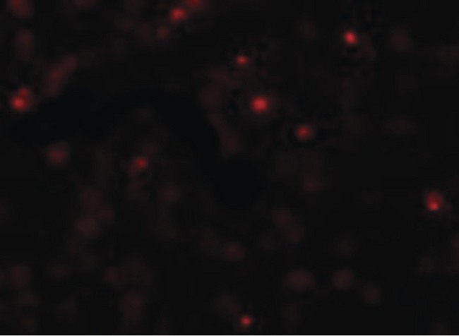 SCUBE2 Antibody - Immunofluorescence of SCUBE2 in Daudi cells with SCUBE2 antibody at 20 ug/ml.