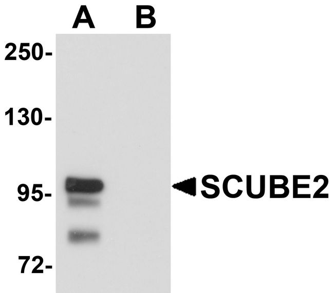 SCUBE2 Antibody - Western blot analysis of SCUBE2 in Daudi cell lysate with SCUBE2 antibody at 1 ug/ml in (A) the absence and (B) the presence of blocking peptide.