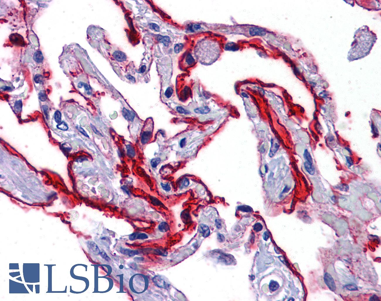 SCUBE2 Antibody - Anti-SCUBE2 antibody IHC of human lung. Immunohistochemistry of formalin-fixed, paraffin-embedded tissue after heat-induced antigen retrieval. Antibody concentration 5 ug/ml.