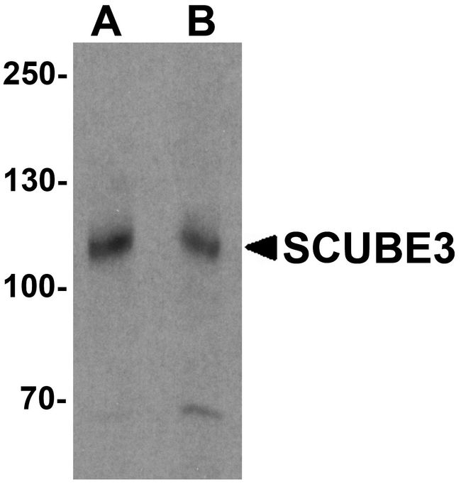 SCUBE3 Antibody - Western blot analysis of SCUBE3 in mouse kidney tissue lysate with SCUBE3 antibody at (A) 1 and (B) 2 ug/ml.