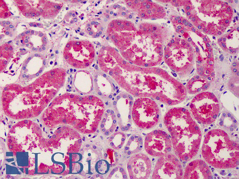 IHC-plus™ SDC1 / Syndecan 1 / CD138 Polyclonal Antibody Rabbit | LSBio