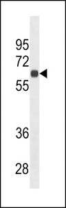 SDC1 / Syndecan 1 / CD138 Antibody - CD138 Antibody (Ascites)western blot of HepG2 cell line lysates (35 ug/lane). The CD138 antibody detected the CD138 protein (arrow).