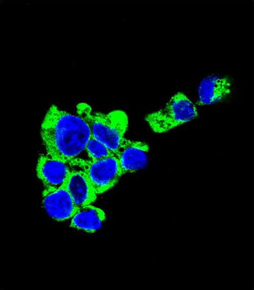 SDC1 / Syndecan 1 / CD138 Antibody - Confocal immunofluorescence of CD138 Antibody (Ascites) with HepG2 cell followed by Alexa Fluor 488-conjugated goat anti-rabbit lgG (green). DAPI was used to stain the cell nuclear (blue).