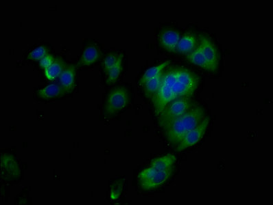 SDC1 / Syndecan 1 / CD138 Antibody - Immunofluorescence staining of HepG2 cells with SDC1 Antibody at 1:145, counter-stained with DAPI. The cells were fixed in 4% formaldehyde, permeabilized using 0.2% Triton X-100 and blocked in 10% normal Goat Serum. The cells were then incubated with the antibody overnight at 4°C. The secondary antibody was Alexa Fluor 488-congugated AffiniPure Goat Anti-Rabbit IgG(H+L).