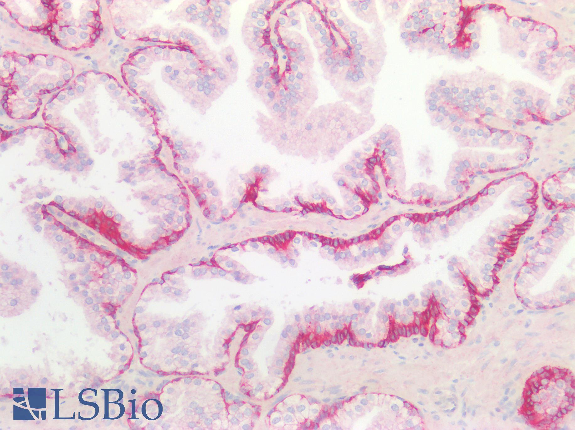 SDC1 / Syndecan 1 / CD138 Antibody - Human Prostate: Formalin-Fixed, Paraffin-Embedded (FFPE)