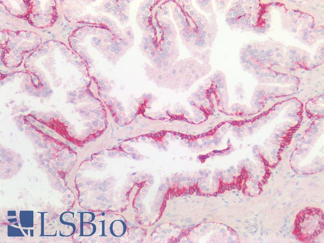 SDC1 / Syndecan 1 / CD138 Antibody - Human Prostate: Formalin-Fixed, Paraffin-Embedded (FFPE)