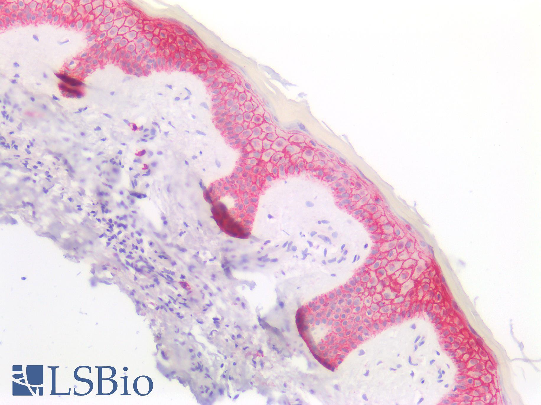 SDC1 / Syndecan 1 / CD138 Antibody - Human Skin: Formalin-Fixed, Paraffin-Embedded (FFPE)