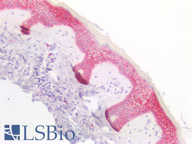 SDC1 / Syndecan 1 / CD138 Antibody - Human Skin: Formalin-Fixed, Paraffin-Embedded (FFPE)