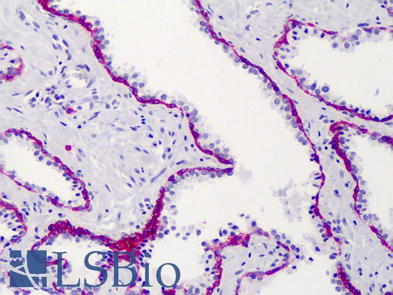 SDC1 / Syndecan 1 / CD138 Antibody - Anti-CD138 antibody IHC of human prostate. Immunohistochemistry of formalin-fixed, paraffin-embedded tissue after heat-induced antigen retrieval. Antibody dilution 1:50.