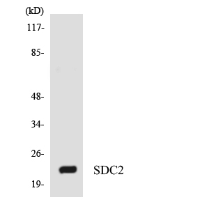 SDC2 / Syndecan 2 Antibody - Western blot analysis of the lysates from RAW264.7cells using SDC2 antibody.
