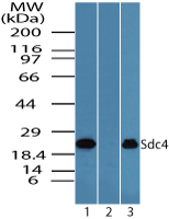 SDC4 / Syndecan 4 Antibody - Western blot of Syndecan-4 in Jurkat cell lysate in the 1) absence and 2) presence of immunizing peptide and 3) Raw cell lysate using SDC4 / Syndecan 4 Antibody at 1.0 ug/ml.