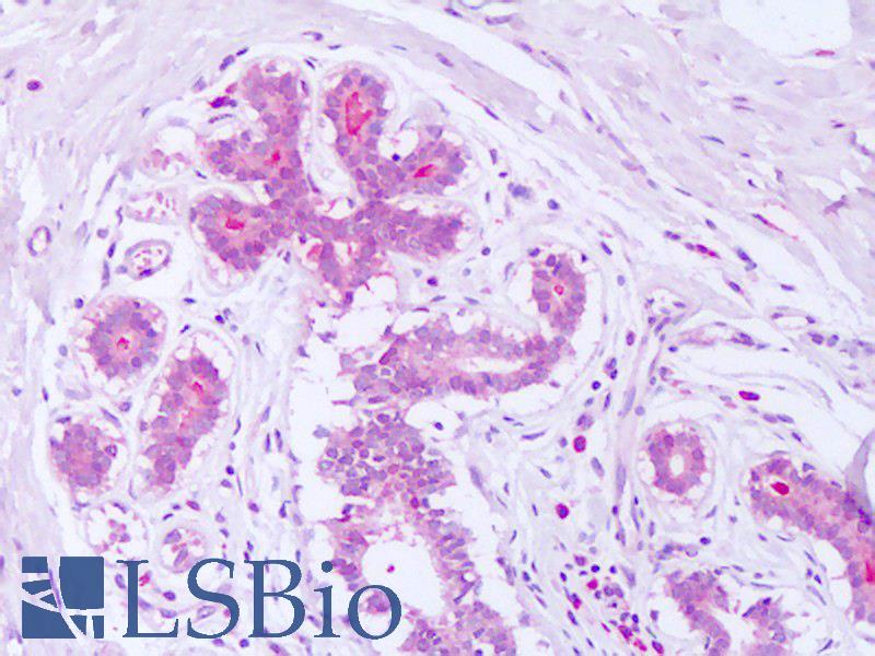 SDCBP / Syntenin Antibody - Anti-Syntenin antibody IHC of human breast. Immunohistochemistry of formalin-fixed, paraffin-embedded tissue after heat-induced antigen retrieval. Antibody dilution 10 ug/ml.