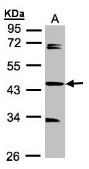 SDCCAG3 Antibody - Sample. A:30g of MOLT4 whole cell lysate . 10% SDS PAGE. SDCCAG3 antibody diluted at 1:1000