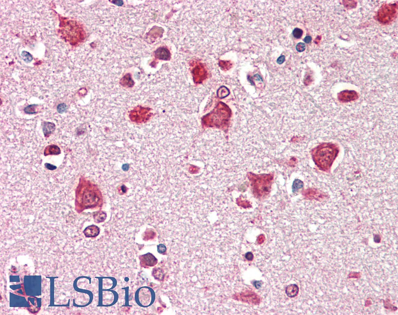 SDCCAG8 Antibody - Anti-SDCCAG8 antibody IHC staining of human brain, cortex. Immunohistochemistry of formalin-fixed, paraffin-embedded tissue after heat-induced antigen retrieval. Antibody concentration 5 ug/ml.