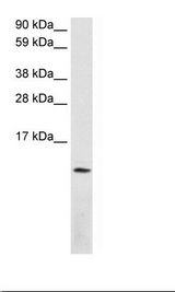 SDF1 / CXCL12 Antibody - Fetal Lung Lysate.  This image was taken for the unconjugated form of this product. Other forms have not been tested.