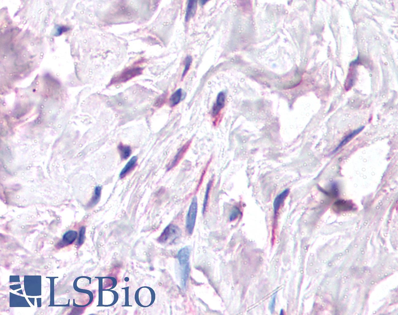 SDF1 / CXCL12 Antibody - Anti-CXCL12 antibody IHC of human breast, fibroblasts. Immunohistochemistry of formalin-fixed, paraffin-embedded tissue after heat-induced antigen retrieval. Antibody concentration 5 ug/ml.  This image was taken for the unconjugated form of this product. Other forms have not been tested.