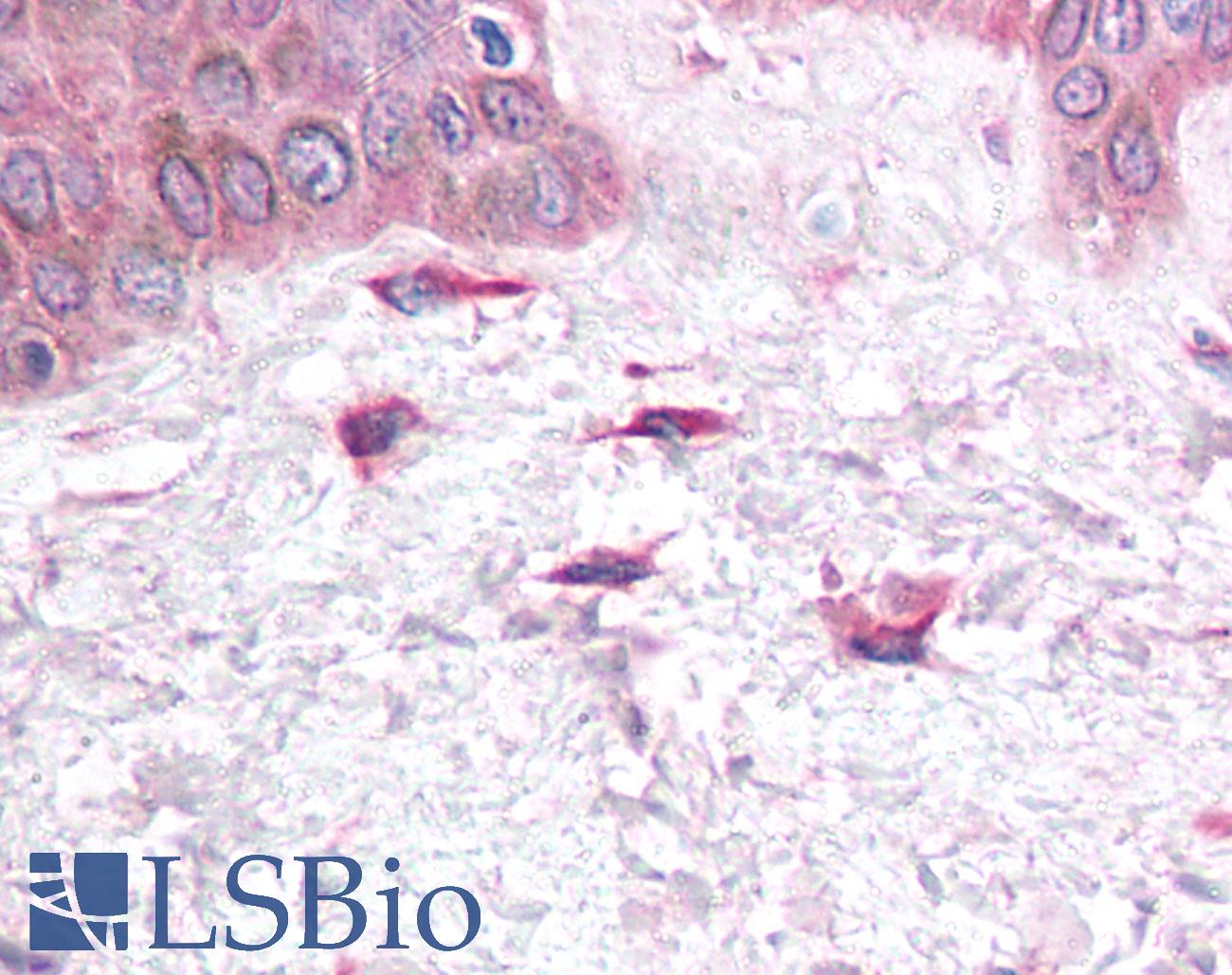 SDF1 / CXCL12 Antibody - Anti-CXCL12 antibody IHC of human skin, fibroblasts. Immunohistochemistry of formalin-fixed, paraffin-embedded tissue after heat-induced antigen retrieval. Antibody concentration 5 ug/ml.  This image was taken for the unconjugated form of this product. Other forms have not been tested.