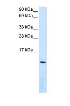 SDF1 / CXCL12 Antibody - CXCL12 antibody Western blot of Fetal Lung lysate. Antibody concentration 1 ug/ml. This image was taken for the unconjugated form of this product. Other forms have not been tested.