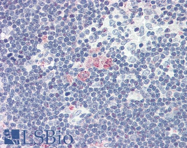 SDF1 / CXCL12 Antibody - Anti-CXCL12 antibody IHC of human thymus. Immunohistochemistry of formalin-fixed, paraffin-embedded tissue after heat-induced antigen retrieval. Antibody concentration 5 ug/ml.
