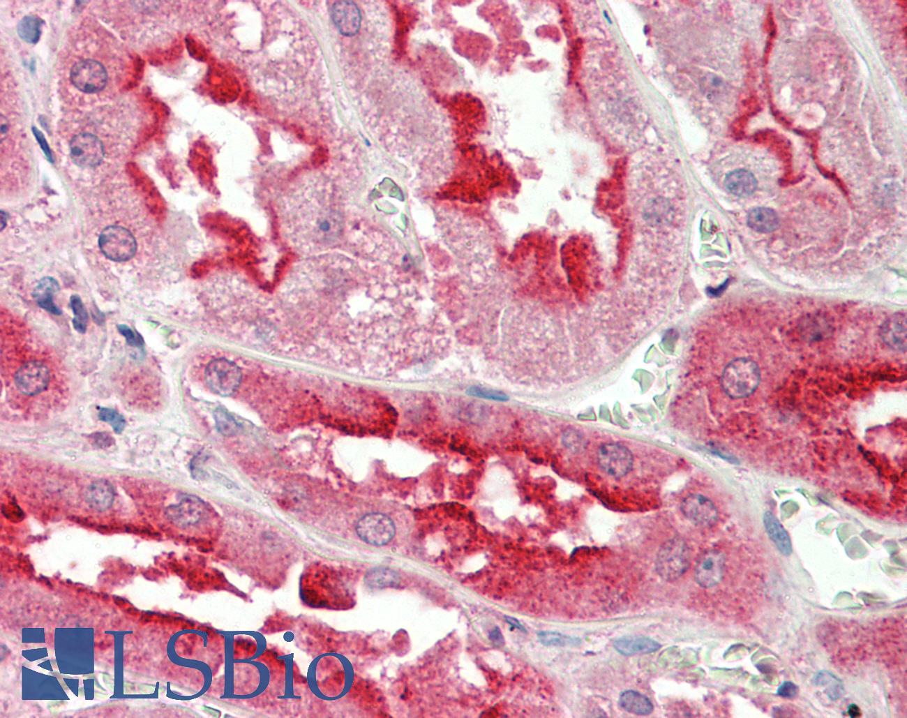 SDF4 Antibody - Human, Kidney: Formalin-Fixed Paraffin-Embedded (FFPE)