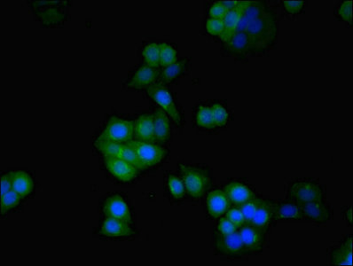 SDHA Antibody - Immunofluorescent analysis of PC-3 cells using SDHA Antibody at dilution of 1:100 and Alexa Fluor 488-congugated AffiniPure Goat Anti-Rabbit IgG(H+L)