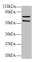 SDHA Antibody - Western blot All lanes: Succinate dehydrogenase [ubiquinone] flavoprotein subunit, mitochondrial antibody at 2µg/ml + 293T whole cell lysate at 20 µg Secondary Goat polyclonal to rabbit IgG at 1/15000 dilution Predicted band size: 73, 68, 57 kDa Observed band size: 73, 57 kDa